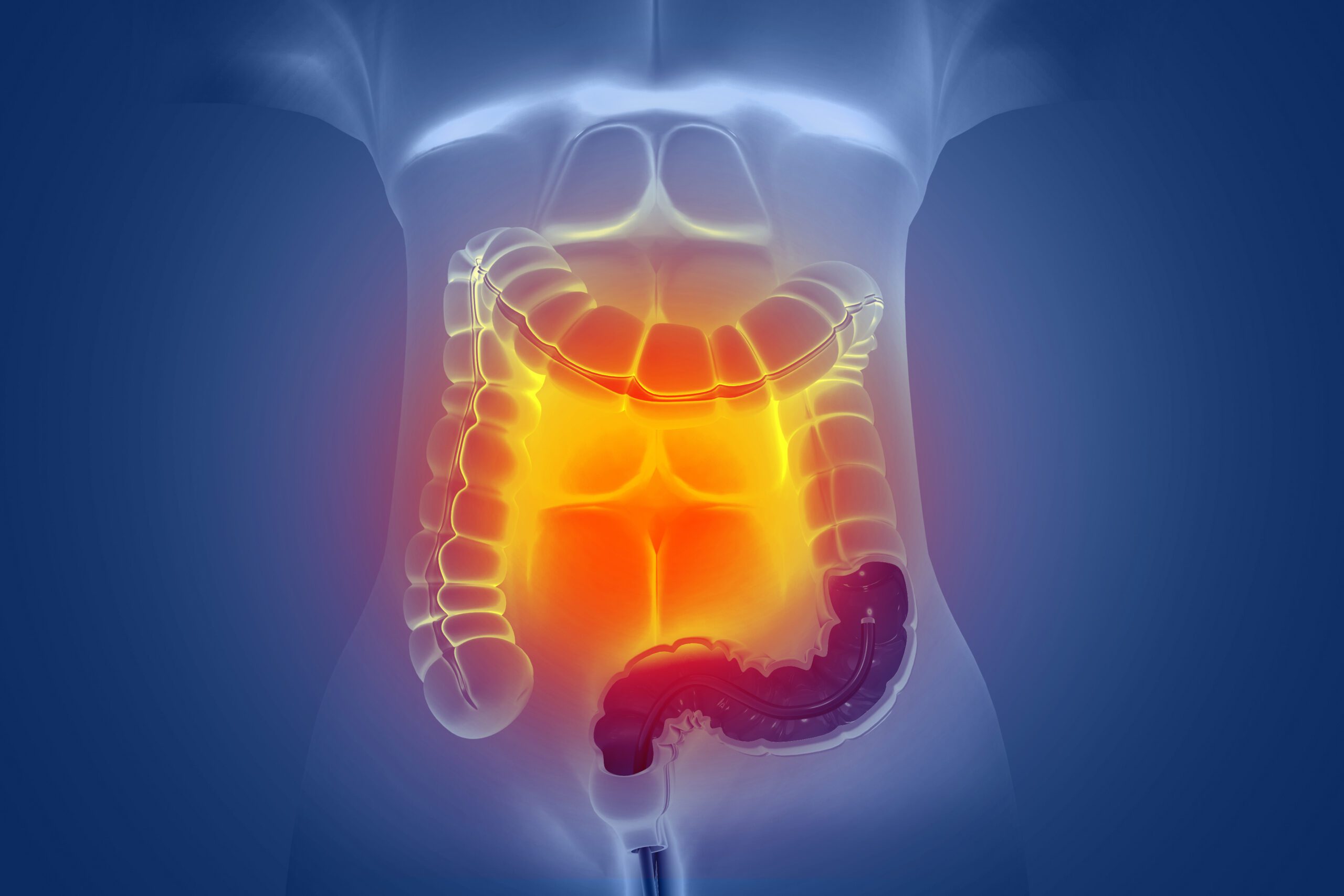 A colonoscopy could save your life. Here are 5 reasons to schedule one ...